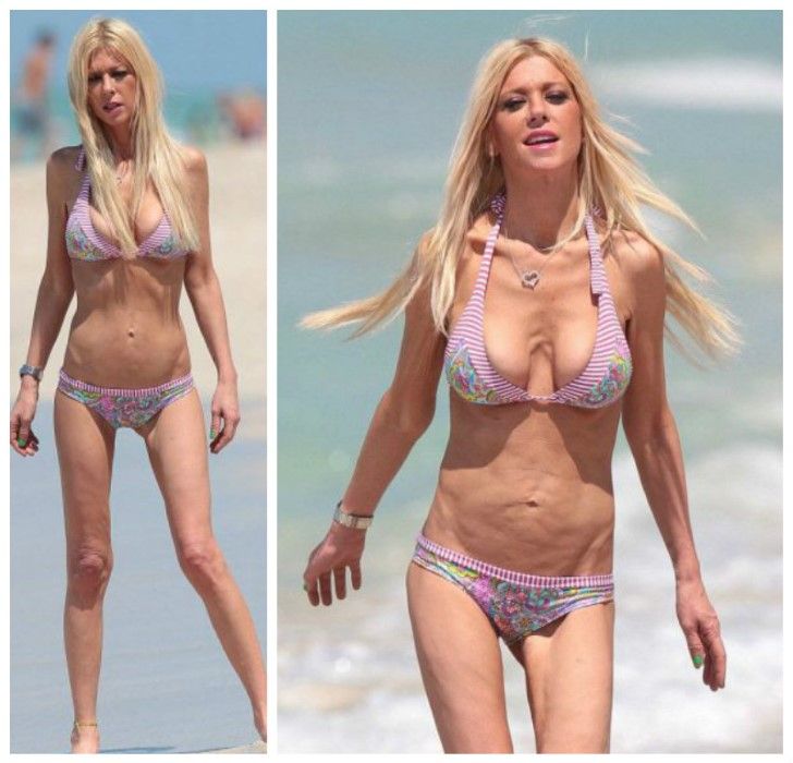 Tara Reid after Plastic surgery